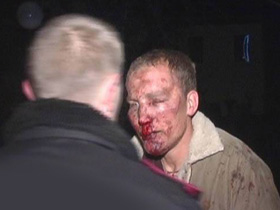 Избитый человек, фото с сайта magnolia-tv.com